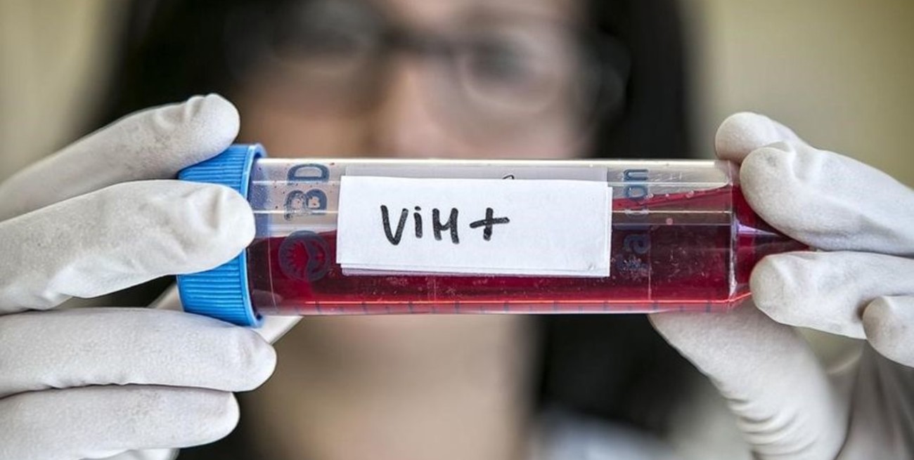 VIH/SIDA: Nuevos avances para facilitar la vida de los pacientes