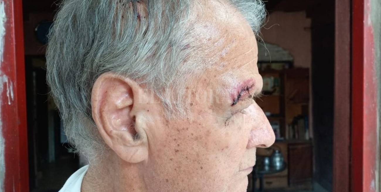 Salvaje robo sufrió un jubilado en su casa en barrio Guadalupe