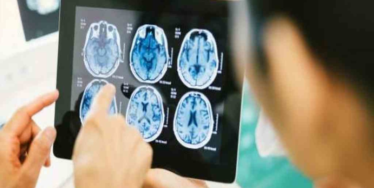 Uno de tres pacientes que tuvo Covid-19 sufre secuelas neurológicas, aún en los seis meses siguientes a la infección