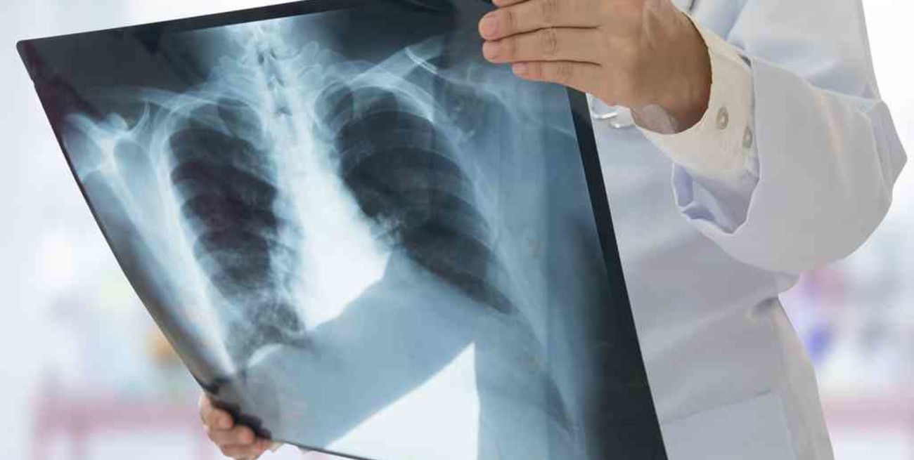 Se registró un aumento de muertes por tuberculosis debido a dificultad de acceso sanitario por la pandemia