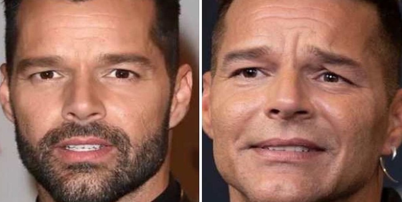 Ricky Martin desmintió haberse operado el rostro