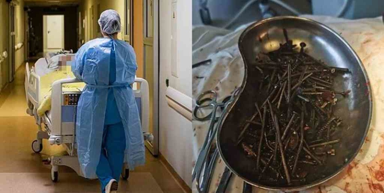 Insólito: extraen más de un kilo de clavos y tornillos del estómago de un hombre