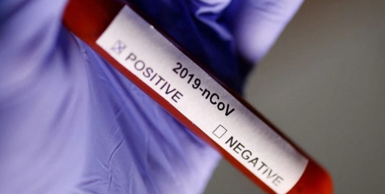 Buscan voluntarios para contraer covid en nombre de la ciencia