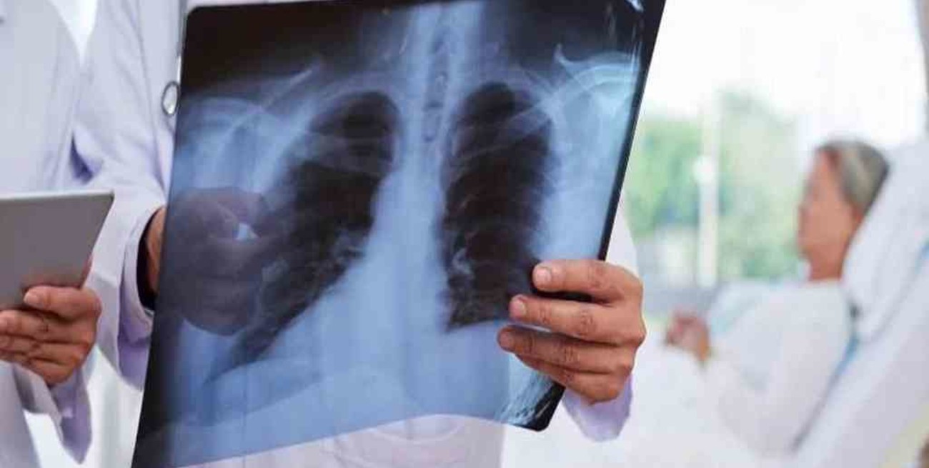 La OMS pidió más financiación para combatir la tuberculosis