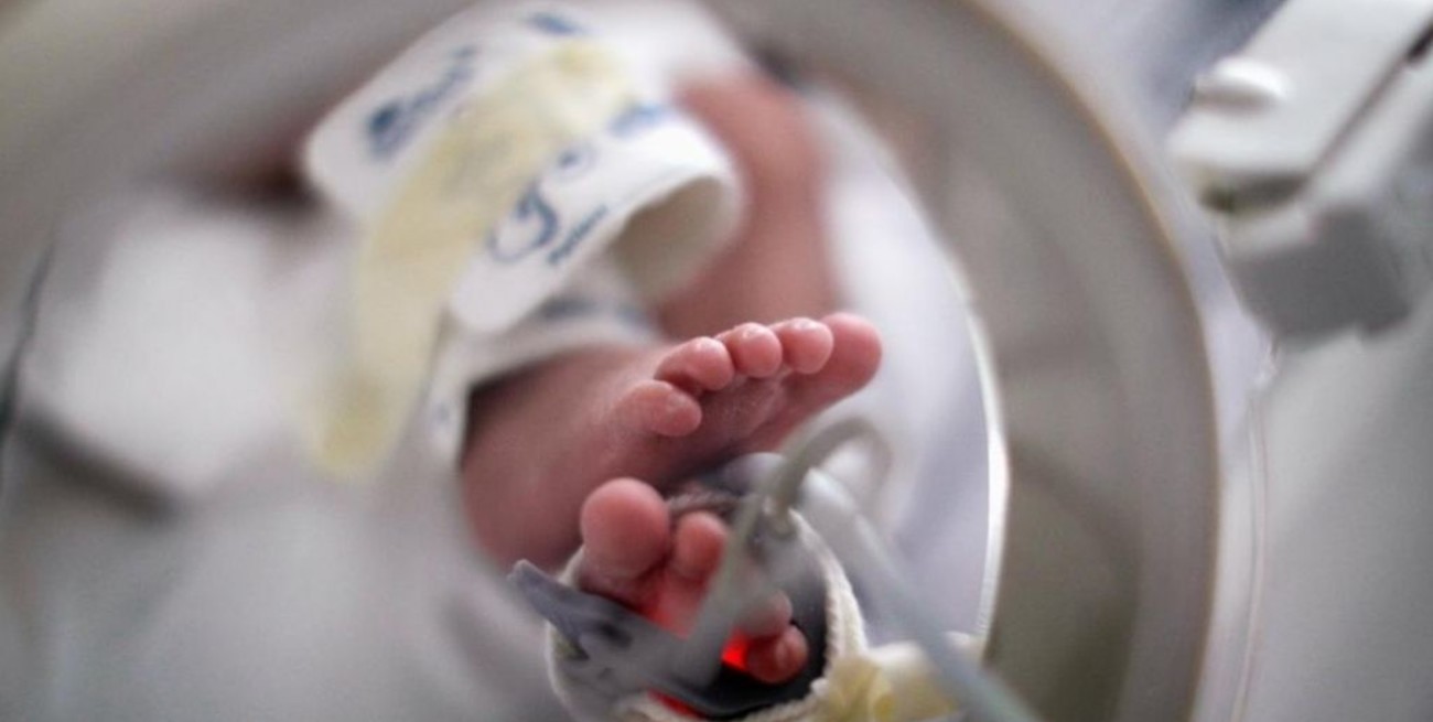 Extraña condición: un bebé nació con dos cabezas, tres manos y dos corazones en la India