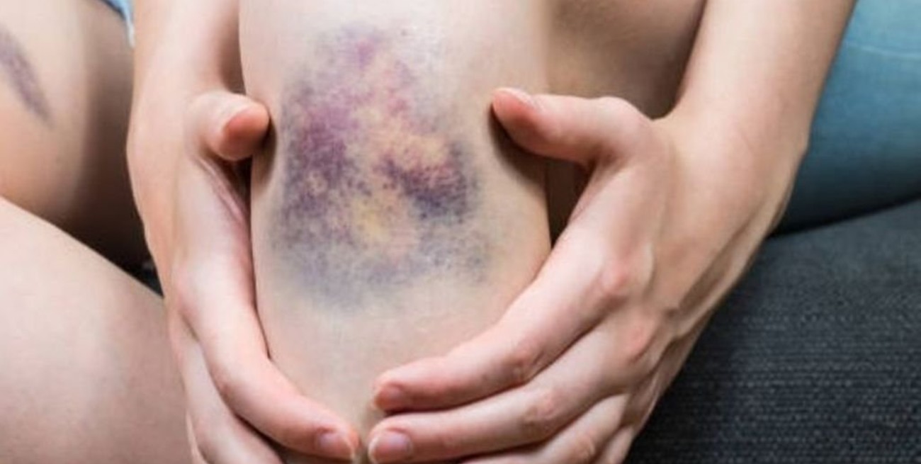 San Juan: le pegaba a su hija con una tabla porque le iba mal en la escuela