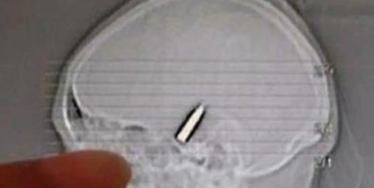 Ingresó al hospital por un accidente pero descubrieron que tenía una bala en la cabeza