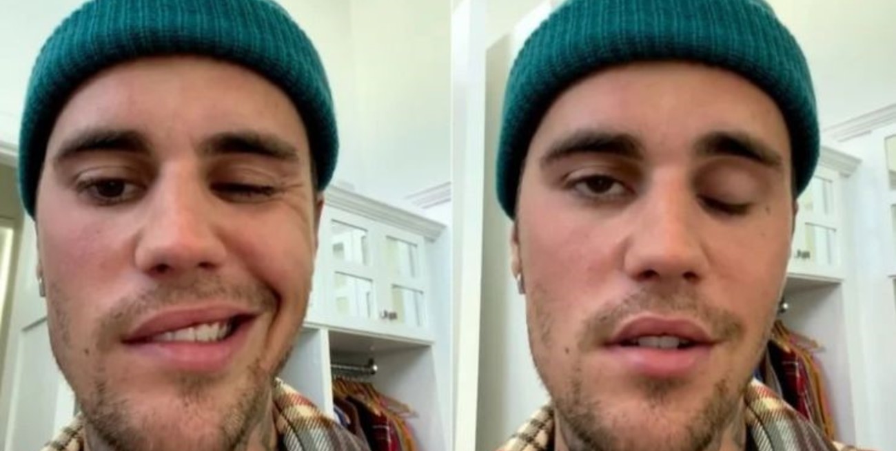 Justin Bieber confesó que sufre de síndrome de Ramsay Hunt