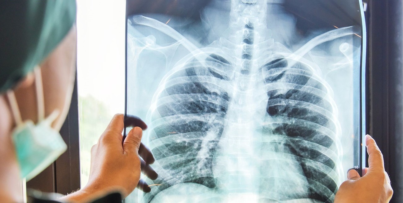 Tuberculosis: una enfermedad "olvidada" pero en aumento