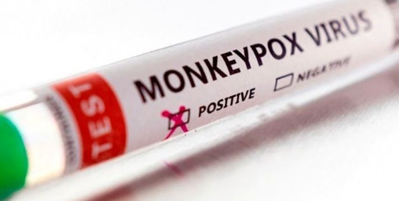 Según la OMS ya hay más de 5000 casos de viruela del mono en el mundo