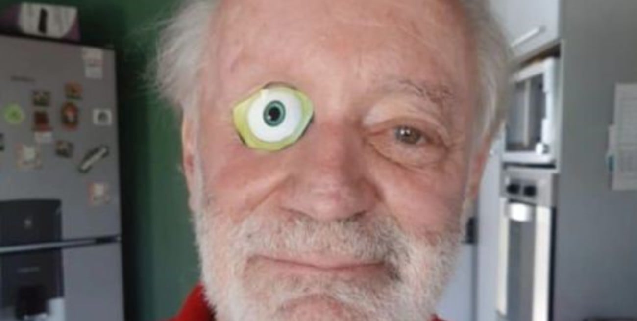 No se pudo registrar en la app Mi Argentina porque le falta un ojo, “pero entran 19 iraníes sin registrarse”