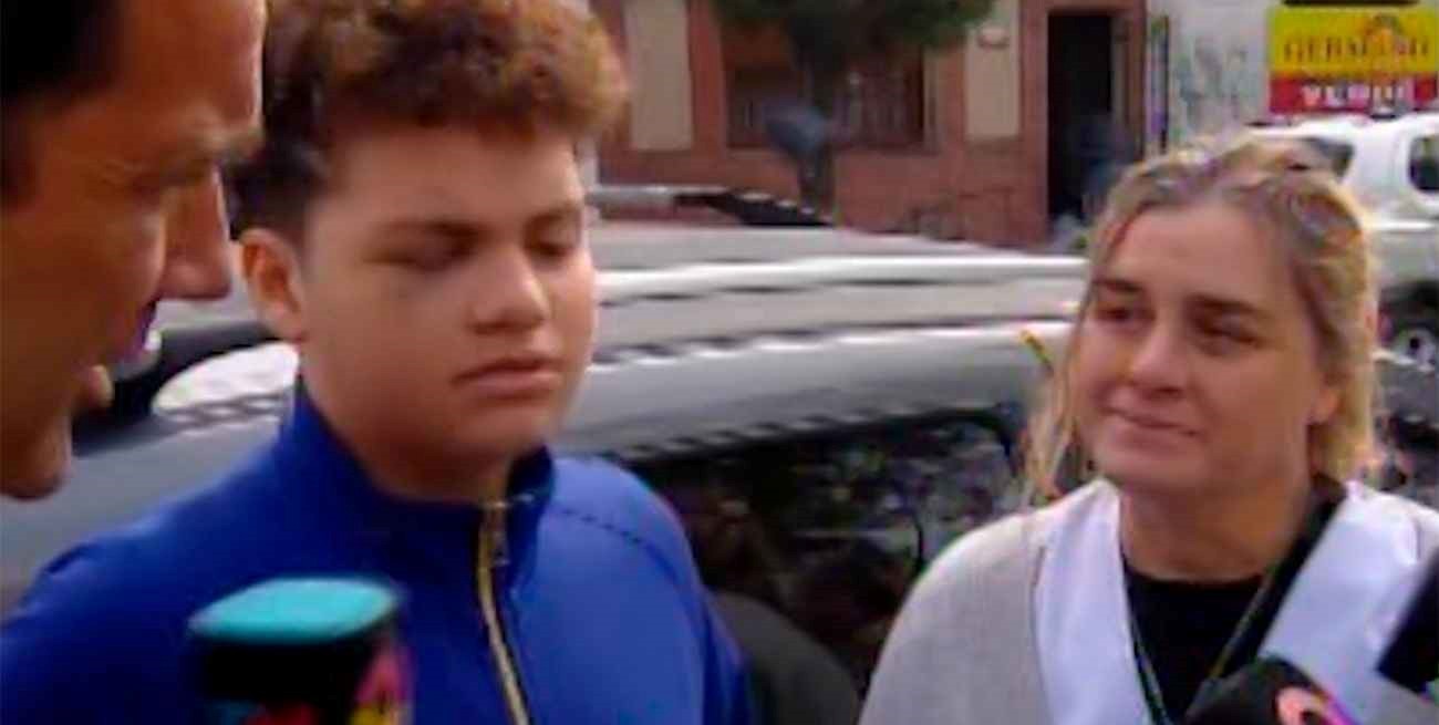 El niño baleado en la cara en La Matanza fue dado de alta: “Estuve a milímetros de perder la visión o morir”