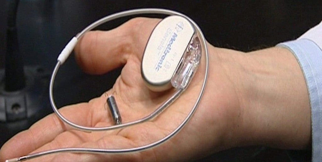 Implantaron marcapasos ultrapequeños por primera vez en Argentina