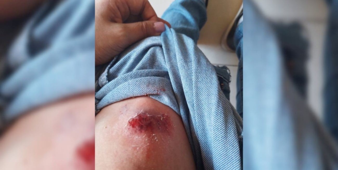 “Me tocó a mí”, el tuit de la movilera radial accidentada