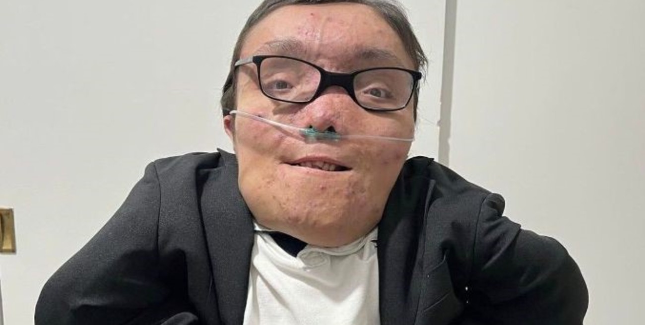 Murió Lucas “Capocha” Alaniz, el joven que luchaba contra sus "huesos de cristal"