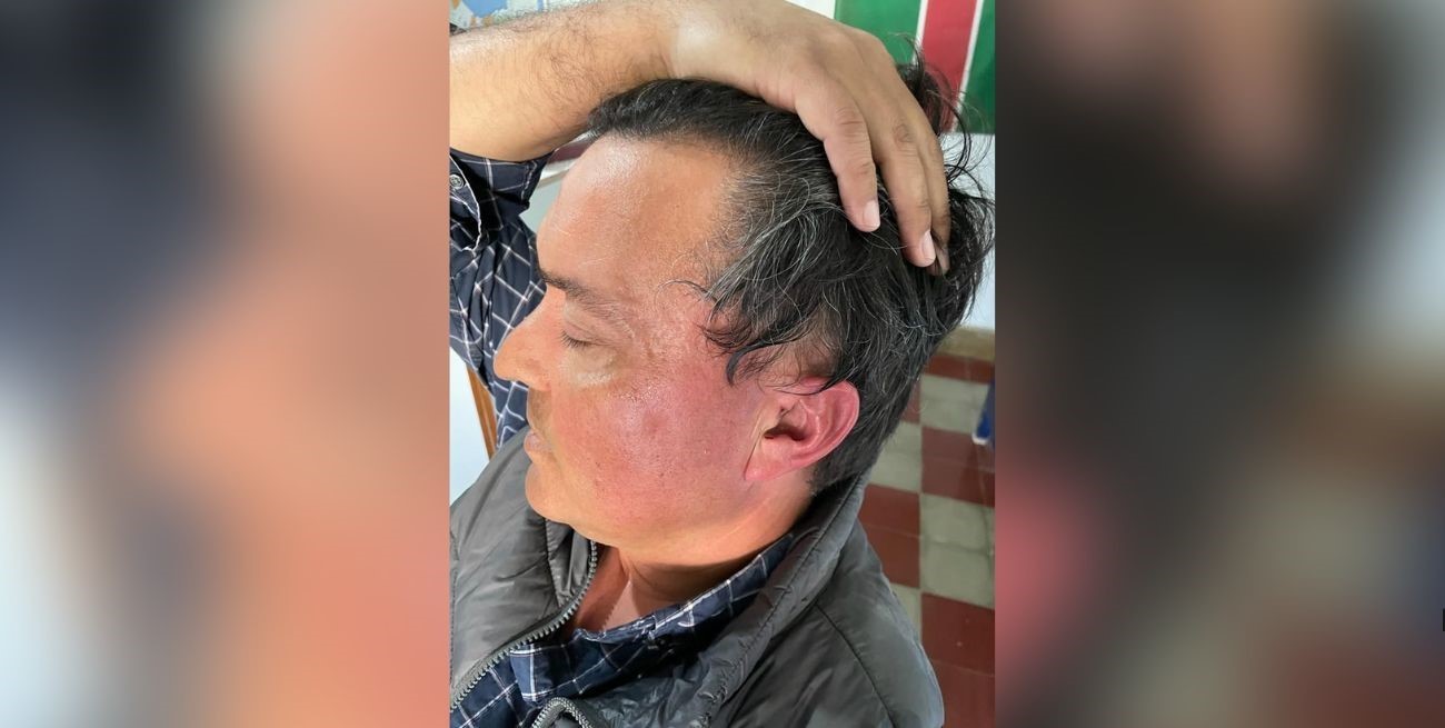 Será querellante el productor golpeado por el presidente comunal de Saralegui