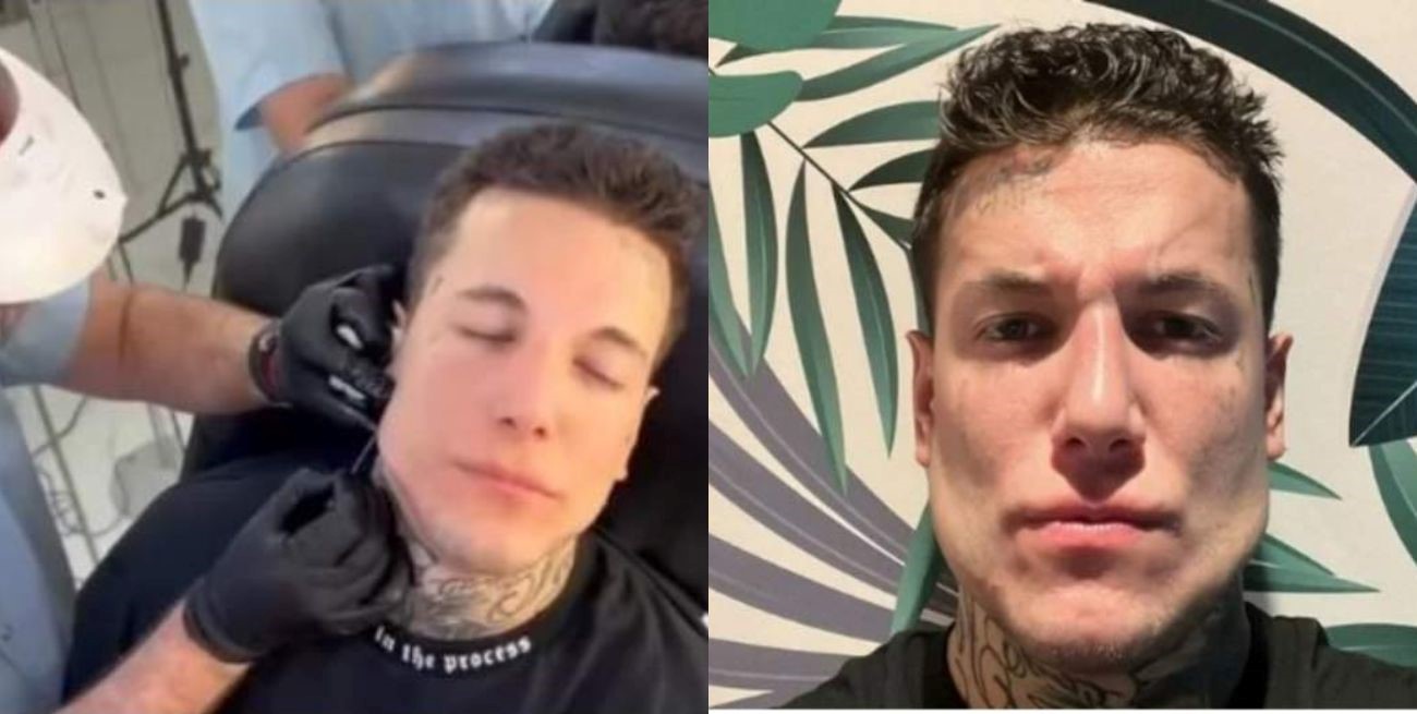 Alex Caniggia se hizo un retoque estético y sorprendió con su nuevo rostro