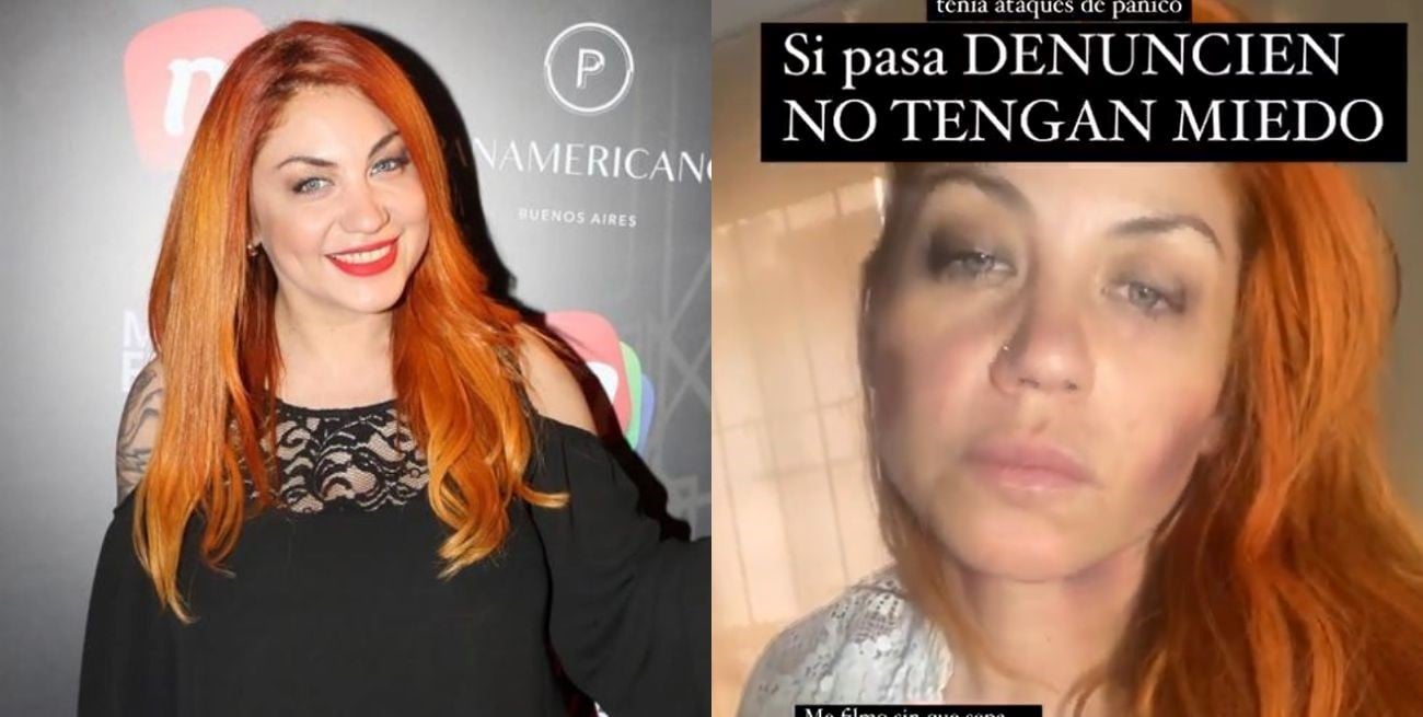 Lourdes de Bandana denunció a su expareja por violencia de género 