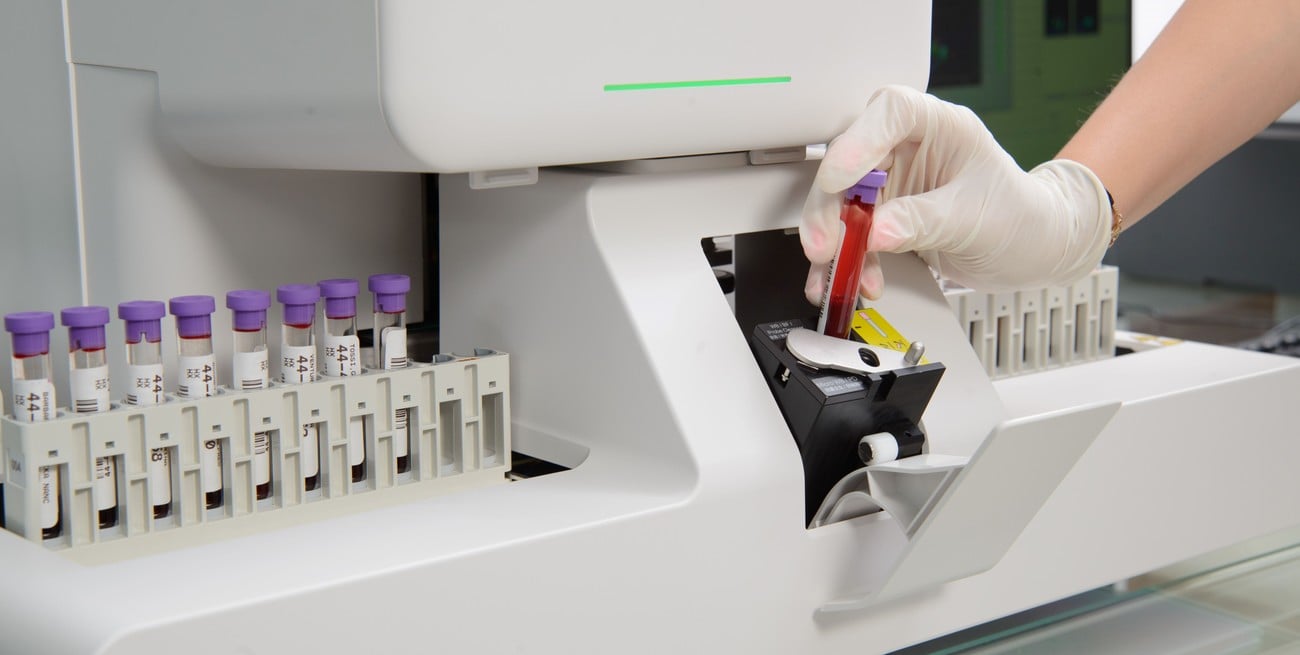 Llega a Santa Fe la oportunidad de un análisis de sangre con mayor valor diagnóstico