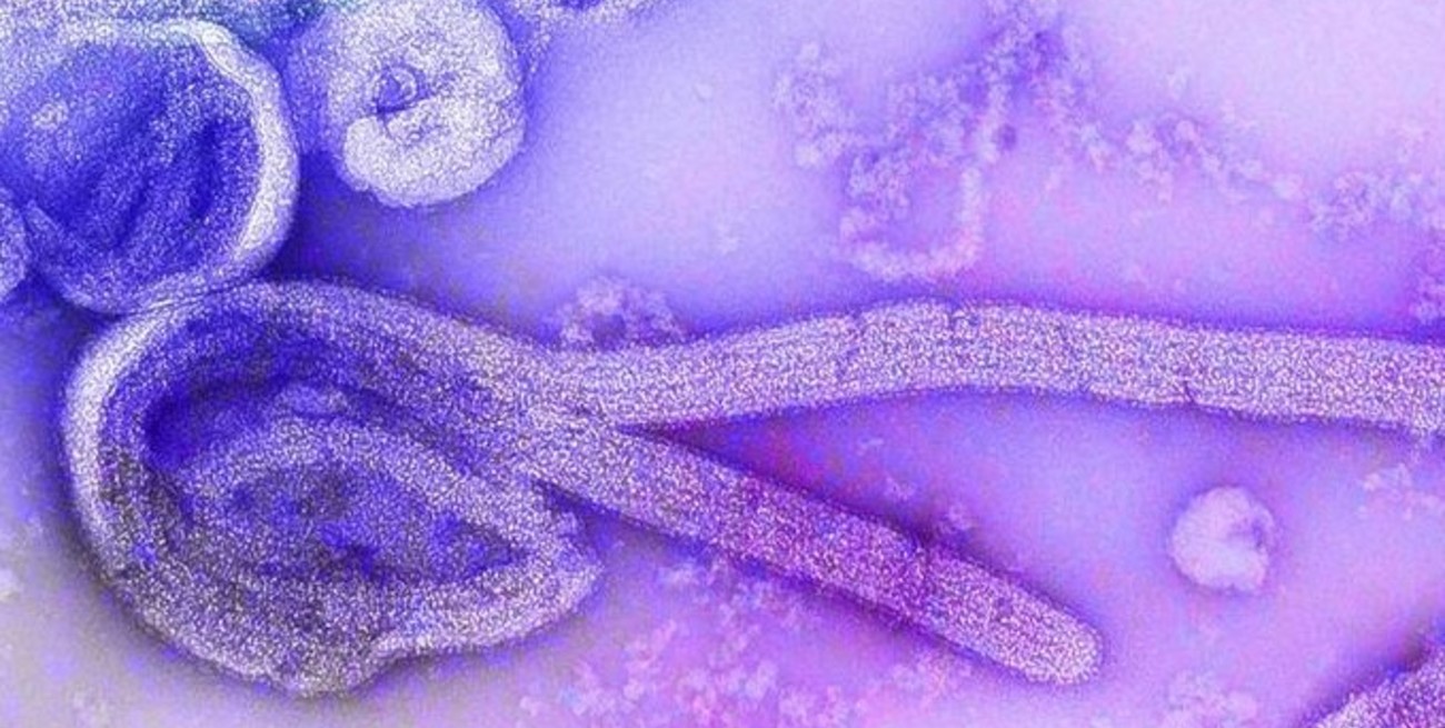 Guinea Ecuatorial confirma brote de virus de Marburgo