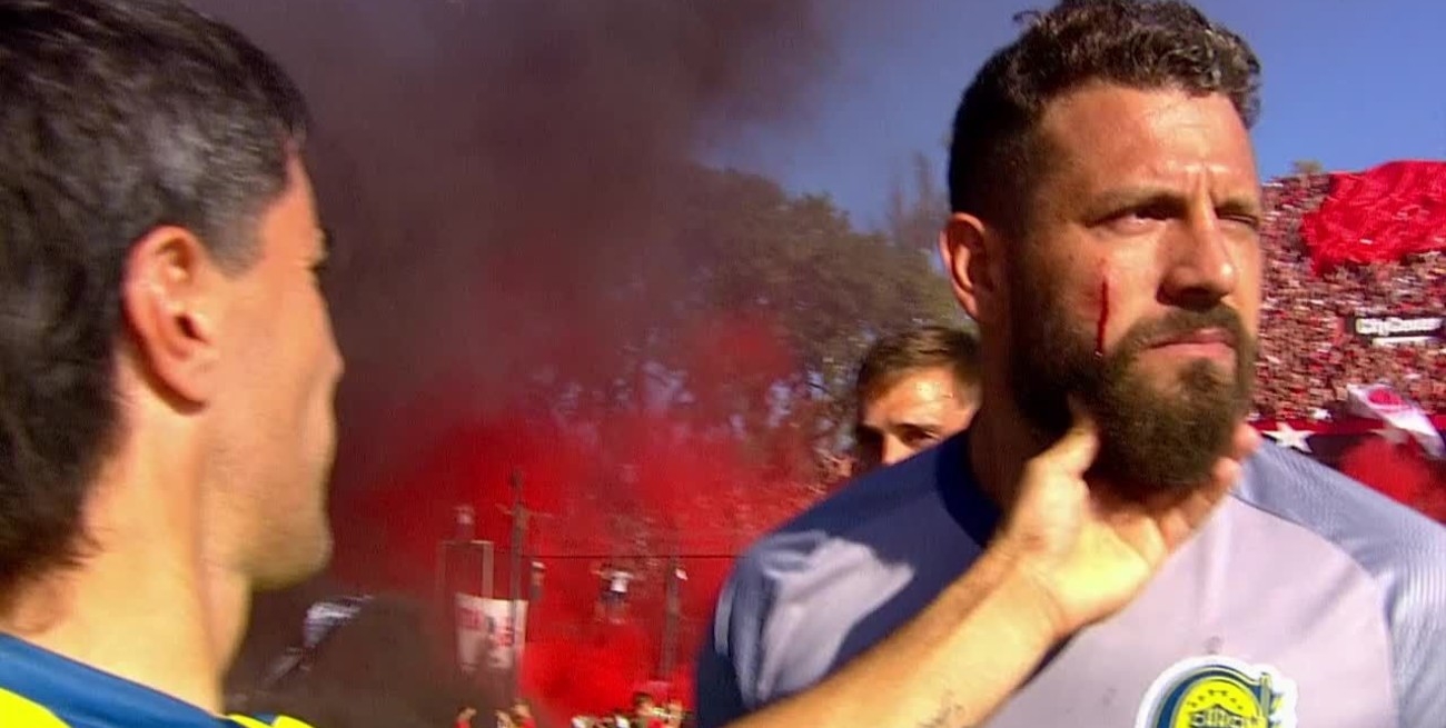 Clásico rosarino: agredieron en el rostro a “Fatura” Broun en la previa de Newell's - Rosario Central