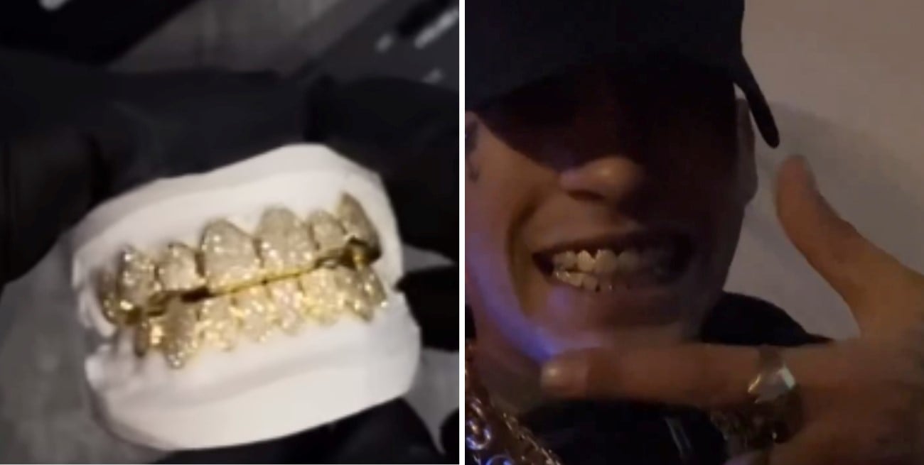 Video: L-Gante estrenó su nueva dentadura con oro de 18 quilates y diamantes