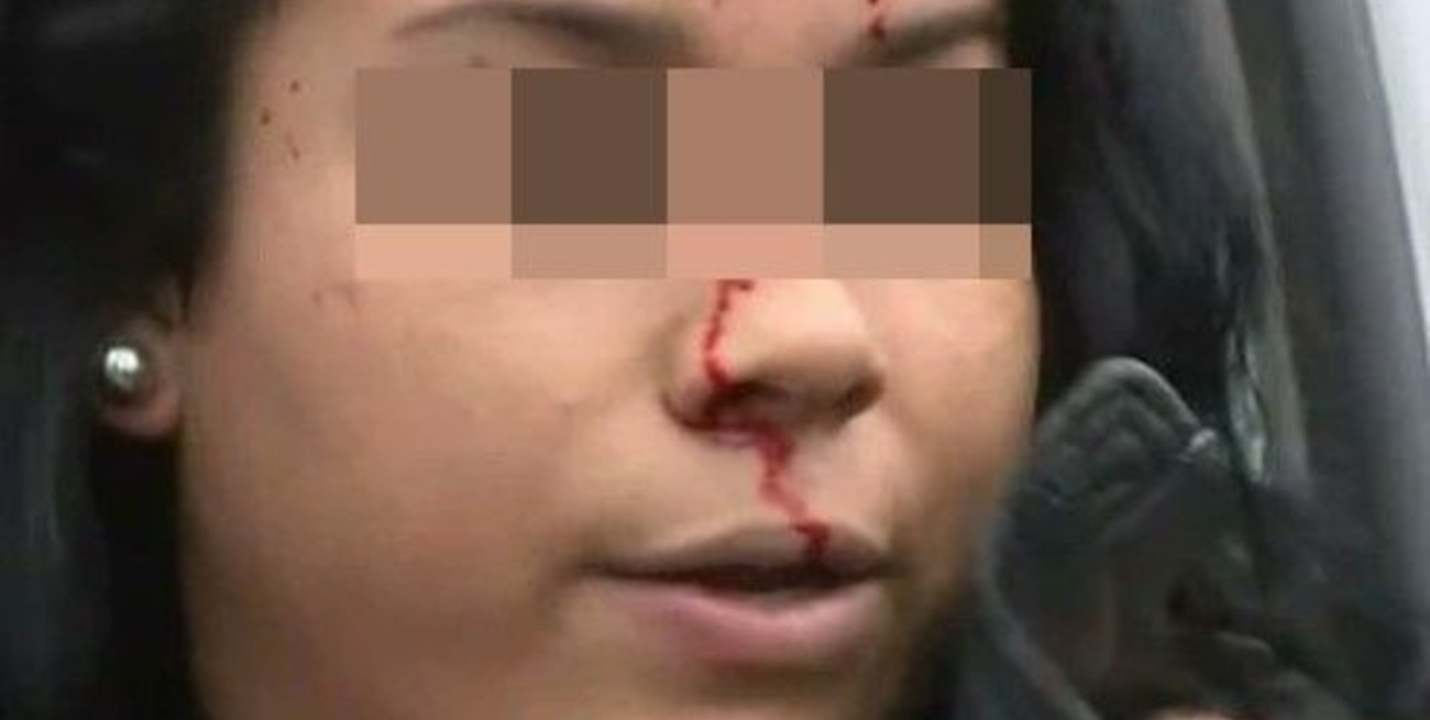 Video: cabeceó el vidrio de un patrullero para fingir que había sido reprimida en Jujuy