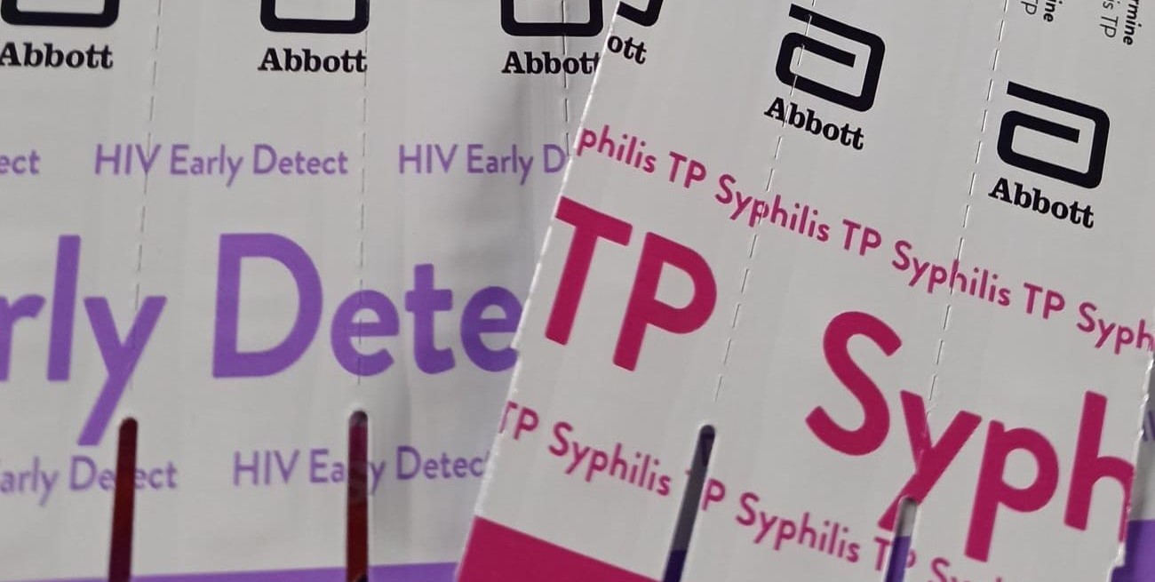 Estiman que el 30% de los infectados con VIH no lo saben