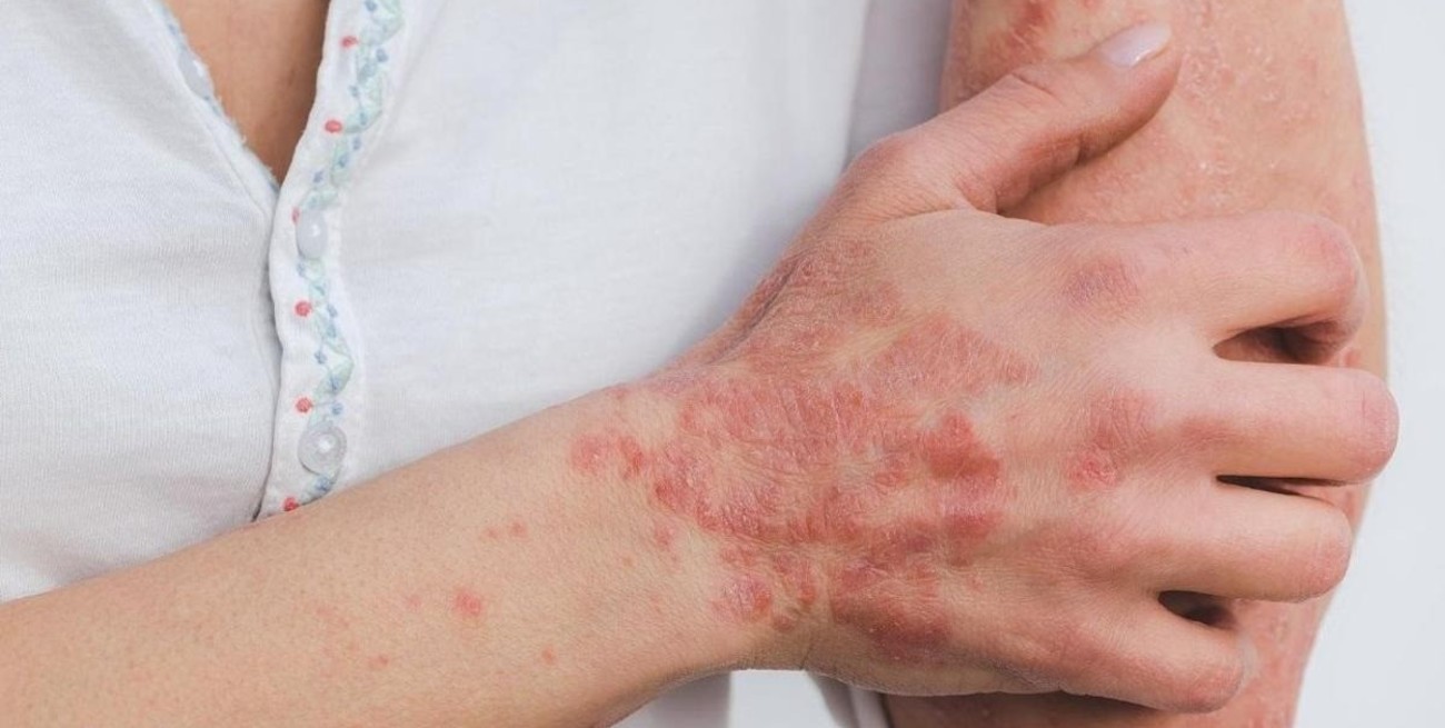 Rehabilitaron el geriátrico donde había abuelos con sarna