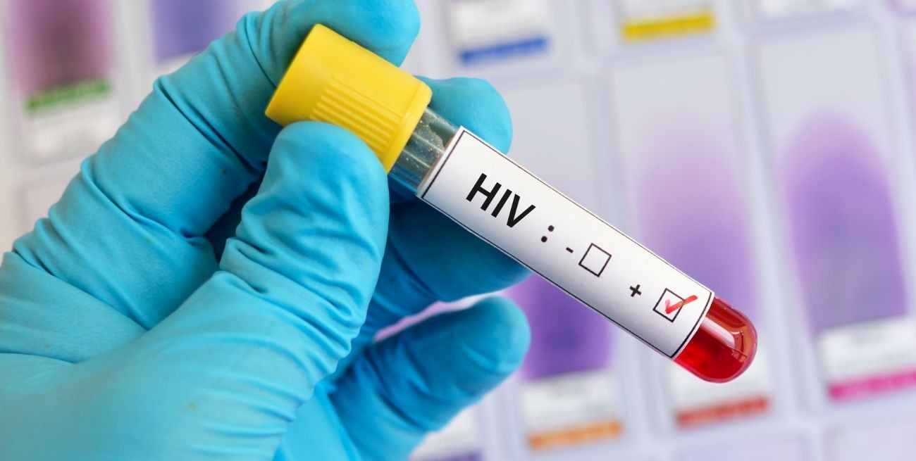 La ONU asegura que el mundo está en camino de eliminar el SIDA para 2030