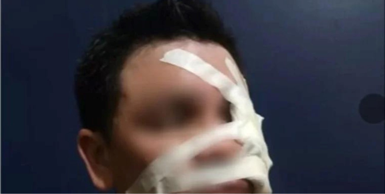 Otra vez: dejó inconsciente de un golpe en la cabeza a un jugador en pleno partido amateur en Corrientes