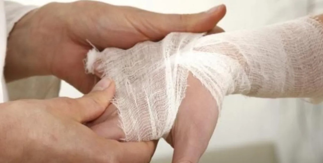 Preocupa el aumento de casos de lepra en Estados Unidos