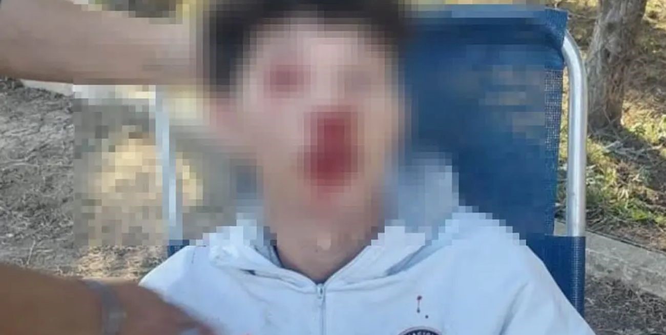 Padres golpearon a dos jugadores de Balnearia en un partido en La Para