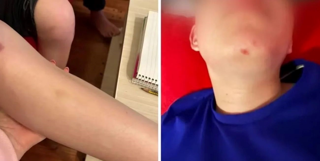 Agresión desmedida: un niño fue golpeado por una pareja con pelotas de golf en Berazategui