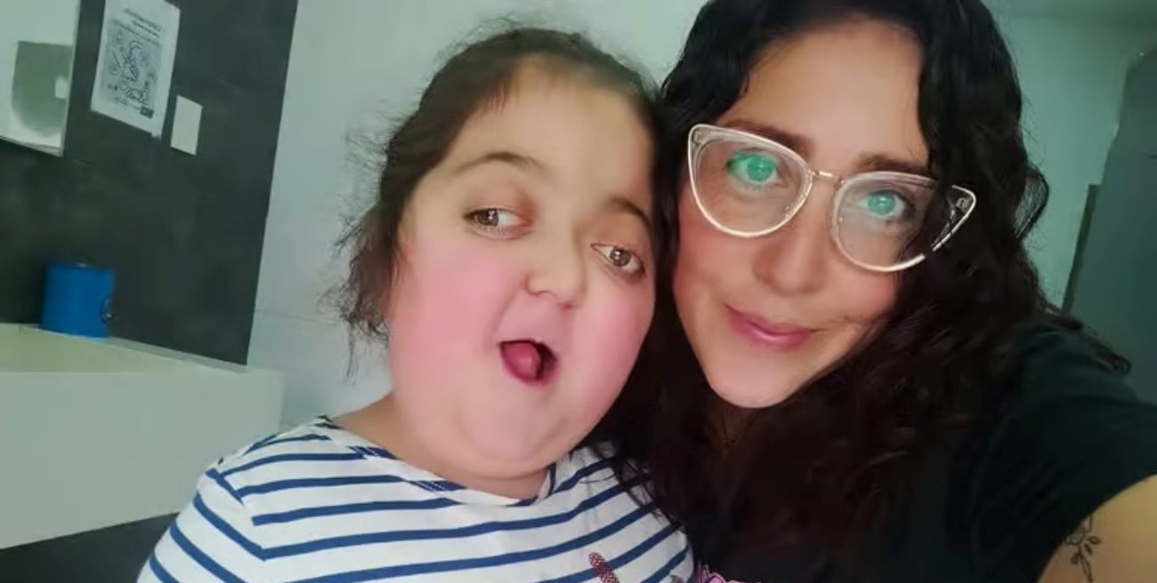 Tiene 6 años, sufre Síndrome de Crouzon y necesita más de 3 millones para ser operada