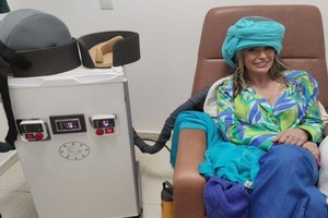 Los cascos fríos para quimioterapias es un método que se viene utilizando hace décadas para evitar la caída del pelo.