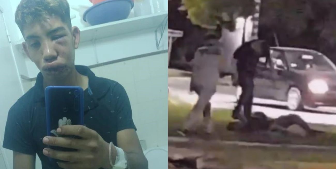 Brutal golpiza a un chico de Casilda: "La estoy contando de milagro"
