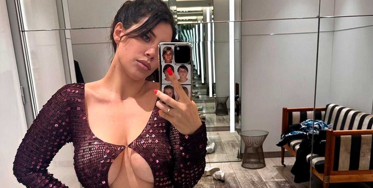 Wanda Nara mostró imágenes del tratamiento que está haciendo