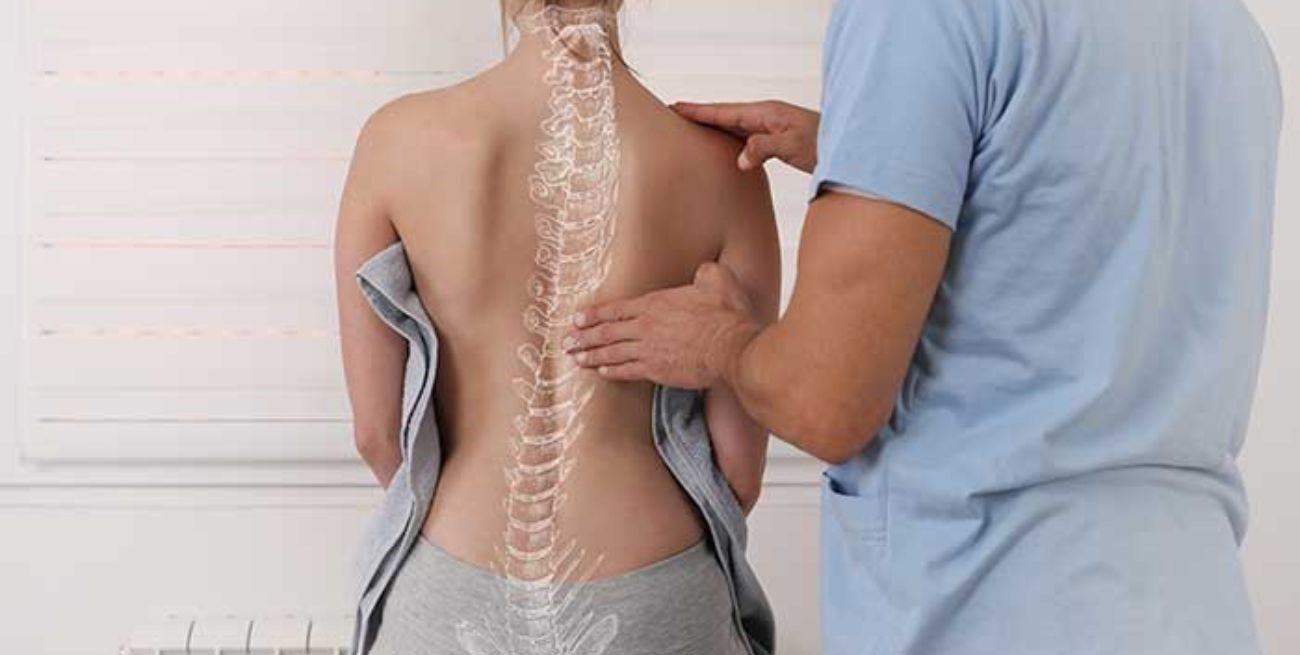 Lo que debes saber sobre la escoliosis