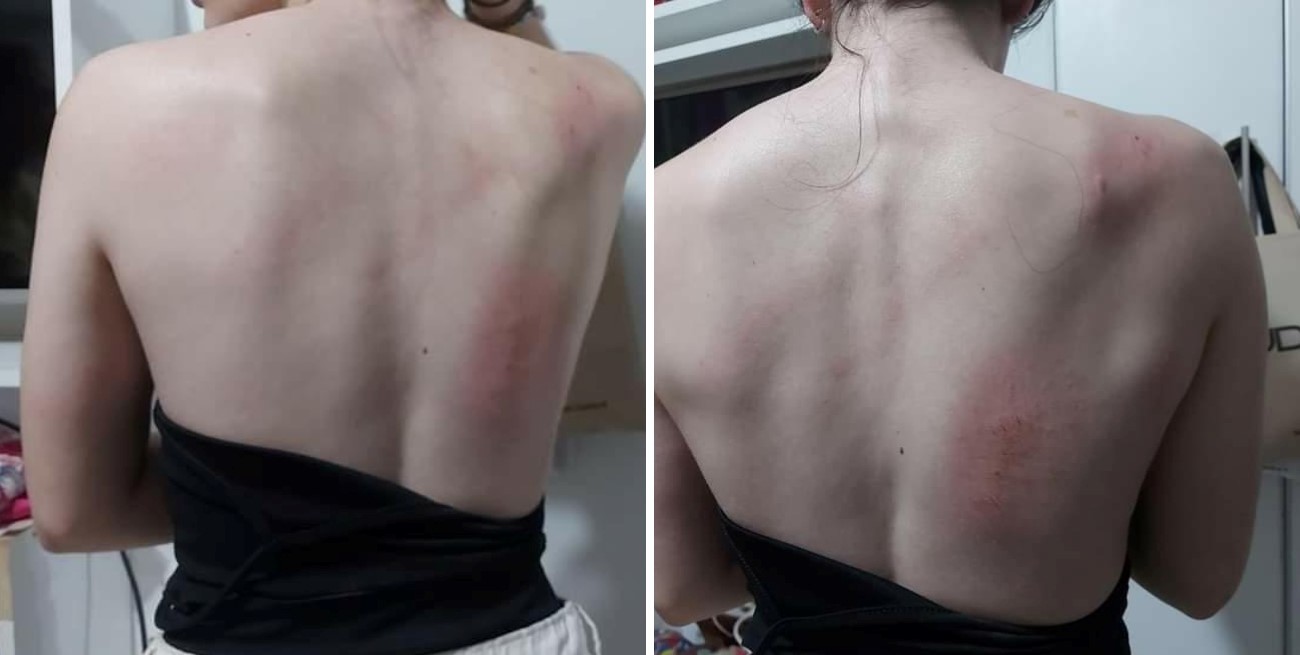 A la salida de un boliche: arrastran a una adolescente por la calle y le roban su celular