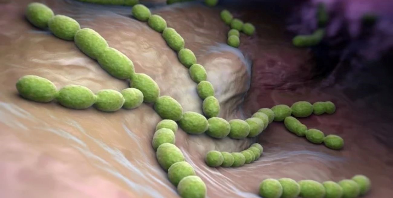 Brote de infecciones agudas causadas por bacterias estreptocócicas