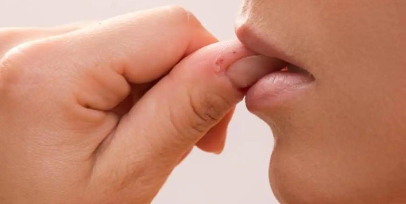 Adiós a las uñas mordidas: consejos para dejar este hábito