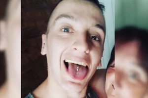 "Moncho" recibió el alta medica tras estar casi un mes en terapia intensiva por diferentes tipos de traumatismos en su cabeza.
