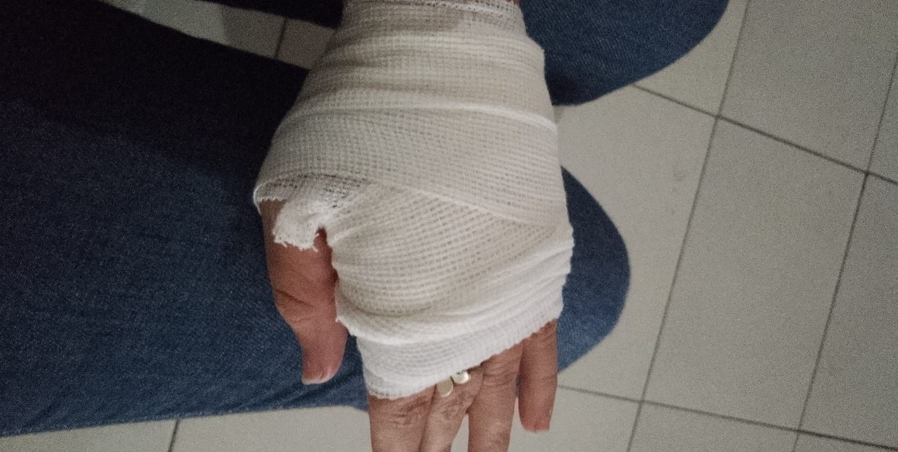 Mujer herida por motochorros en la ciudad de Santa Fe