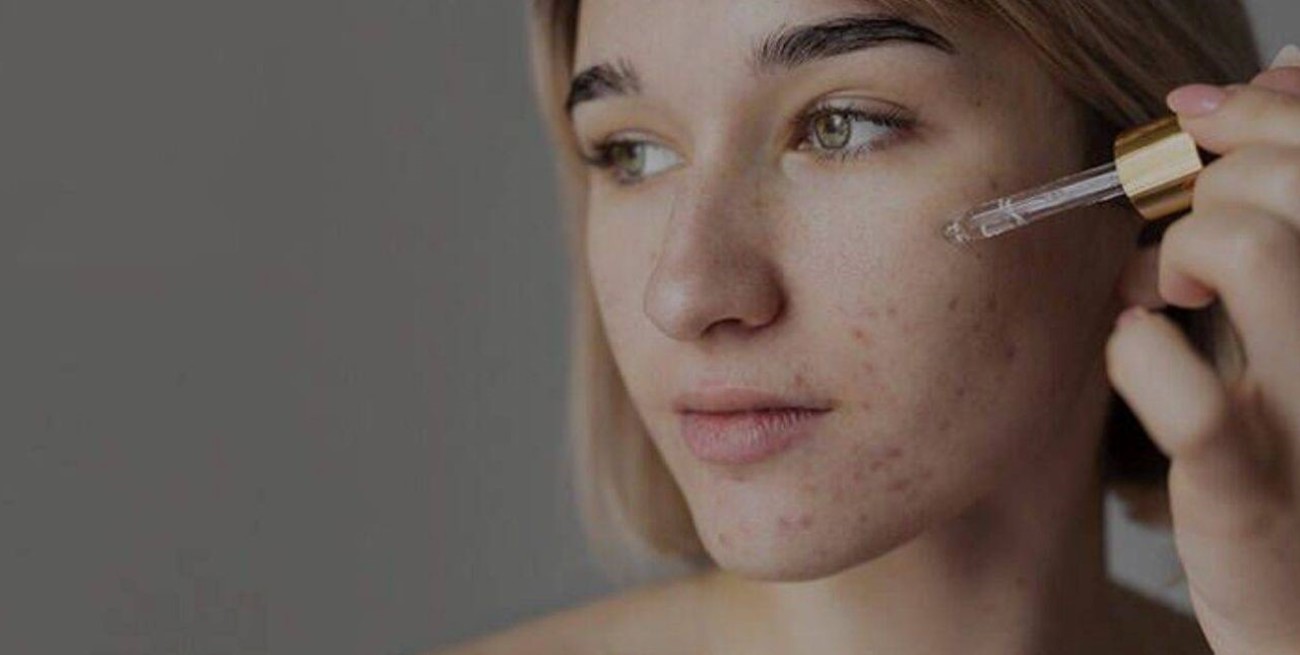 Ácido salicílico: el aliado indispensable en el cuidado de la piel