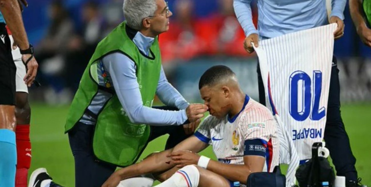 Video: Mbappé se fracturó la nariz y será operado en Alemania