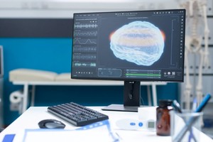 Este tipo de hallazgos son trascendentales, ya que “la mayoría de las cosas que realmente terminan aplicándose en humanos y generan grandes revoluciones en la medicina surgen de investigaciones básicas”, asegura.