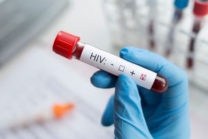 En 2023, las nuevas infecciones por VIH a nivel mundial cayeron a niveles no vistos desde finales de la década de 1980.