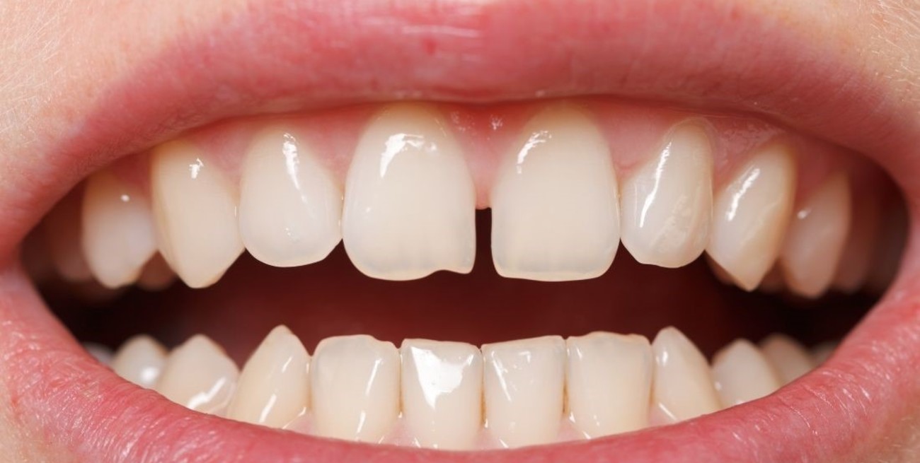 Medicamento que podría regenerar los dientes perdidos: lo que se sabe hasta ahora