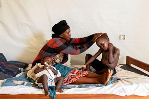 Una mujer aplica medicamentos a su hijo bajo tratamiento por la mpox en la República Democrática del Congo. Reuters.
